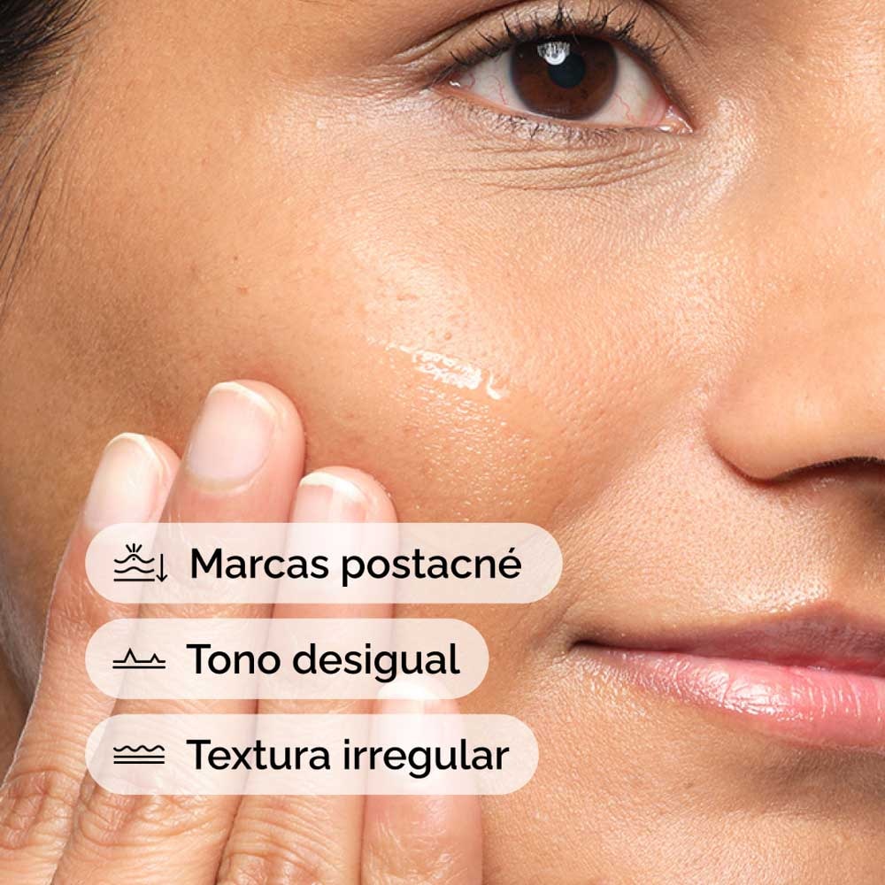 ALOE 2% + NAG SOLUTION  (SUERO PARA TRATAMIENTOS POST ACN&Eacute; CON ALOE)